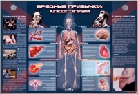 Электрифицированный стенд "Вредные привычки: алкоголизм" - «globural.ru» - Сочи