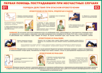 Таблица Порядок действий при опасном кровотечении 1000*1400 винил - «globural.ru» - Сочи